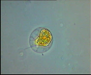 Haematococcus pluvialis